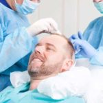 مشکلات و عوارض کاشت مو | بهترین روش کاشت مو در حال حاضر چیست؟