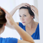 کاشت مو برای زنان