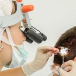 کاشت مو با تکنیک جداسازی فولیکولار (FIT) | مزایا و عوارض جانبی