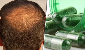 5 تا ویتامین برای رشد موها | جلوگیری از ریزش مو | کاشت مو 