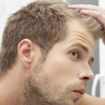 مراقبت از پوست سر بعد از کاشت مو | نحوه خوابیدن پس از کاشت مو