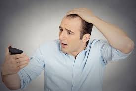 گزینه های درمان ریزش مو که اثر گذار هستند