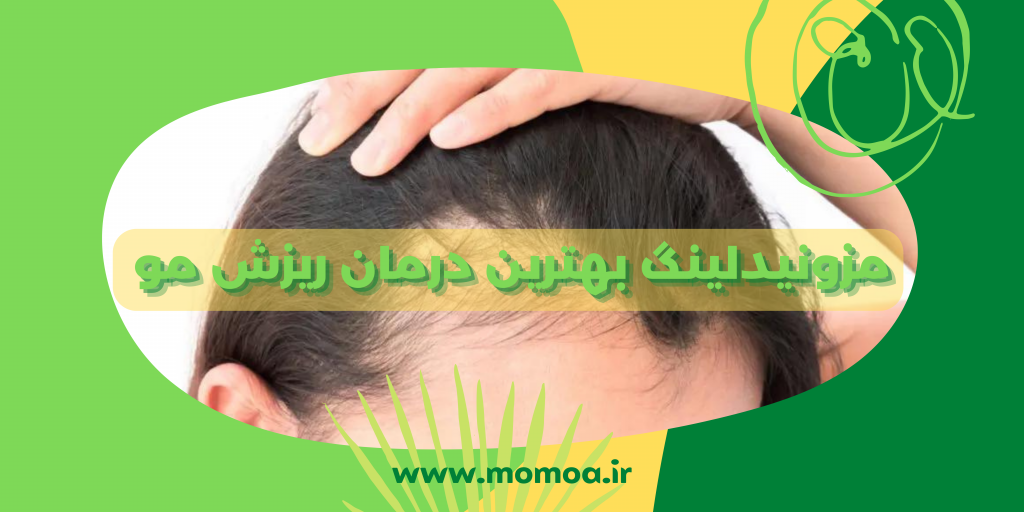 مزونیدلینگ مو چیست