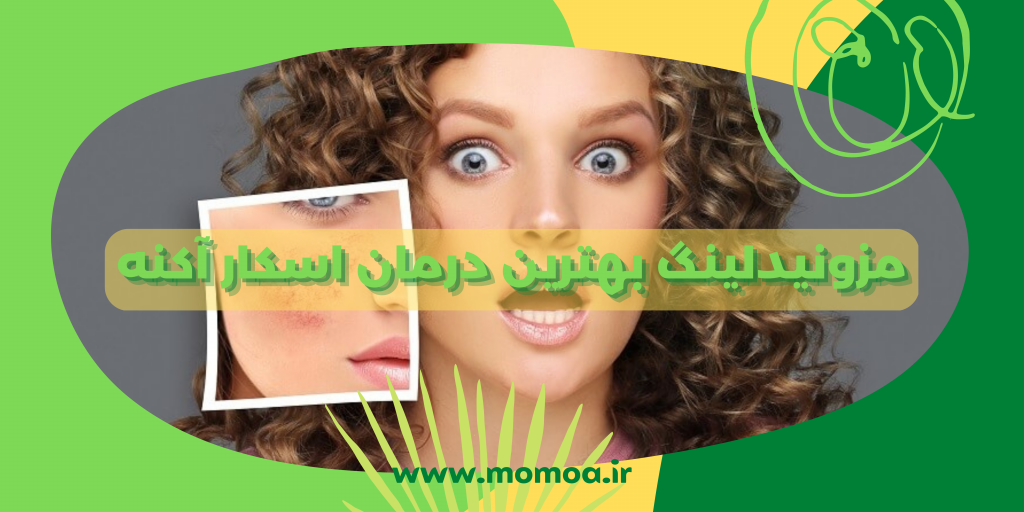 میکرونیدلینگ برای جای جوش